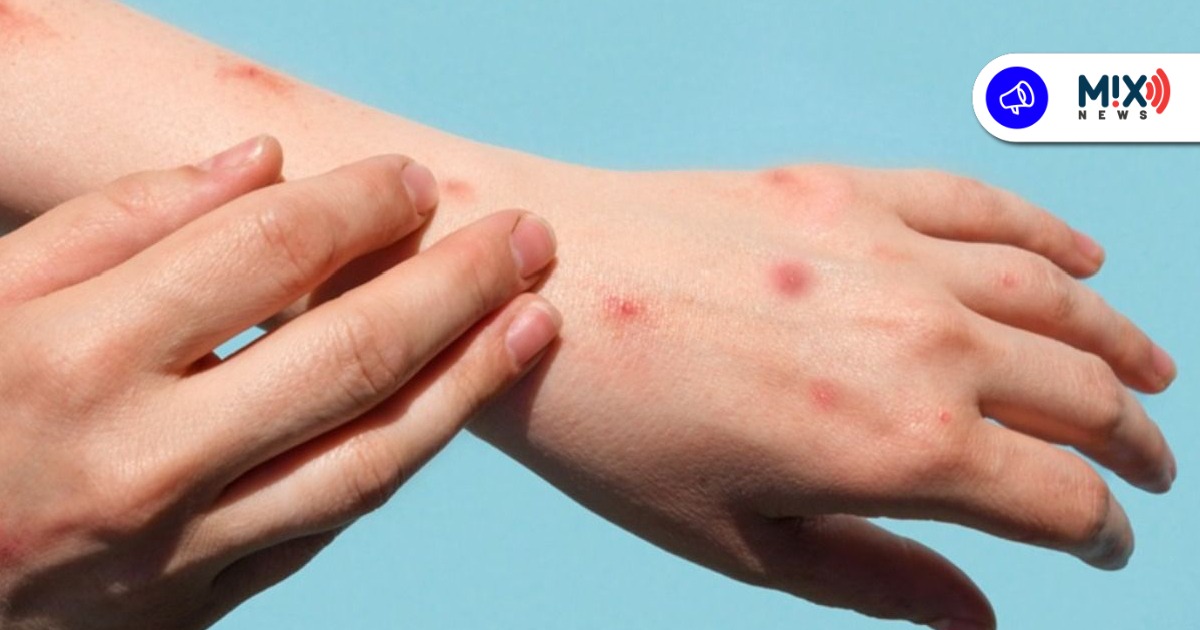 Escuelas no son foco de riesgo sanitario por sarampión