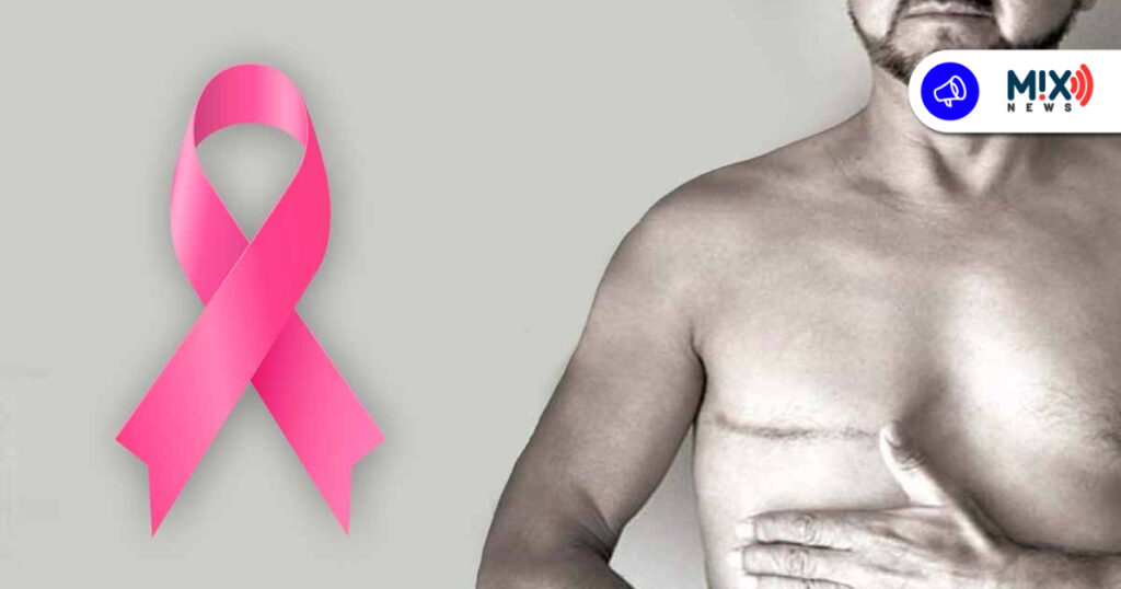 Fallece hombre por cáncer de mama