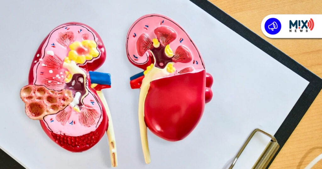 Aguascalientes 1er lugar mundial de daño renal en jóvenes